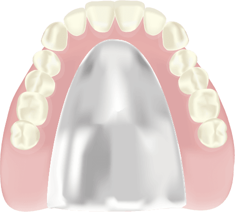 金属床（コバルトクロム・チタン）の総入れ歯